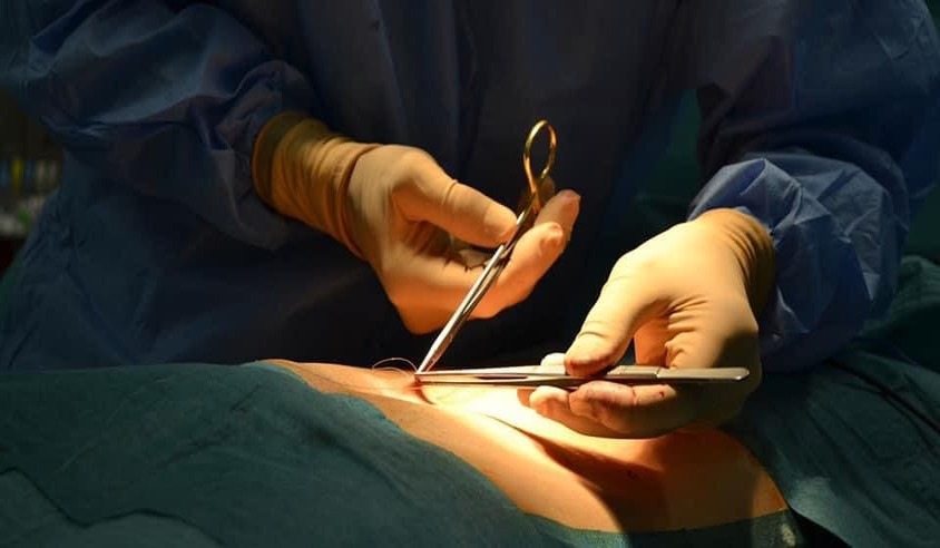 Opération chirurgicale avec bistouri